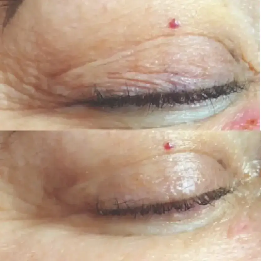 a close up of a person's left eye