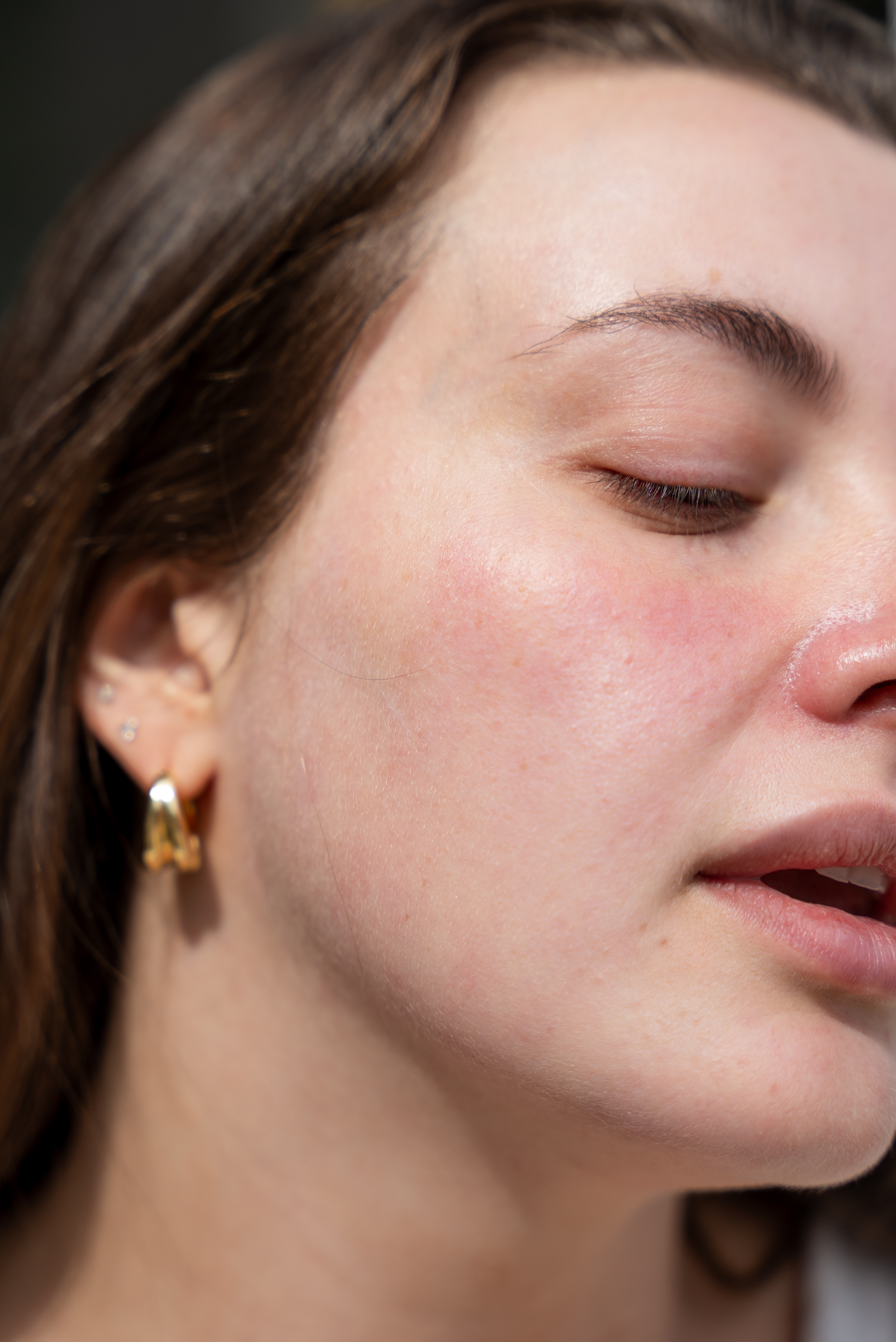 CoolPeel® CO₂ Laser Resurfacing