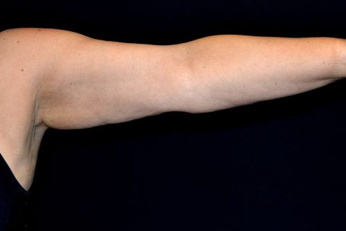 Before And After Patient Image