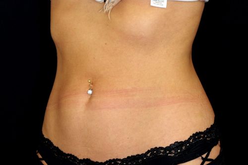 Before And After Patient Image