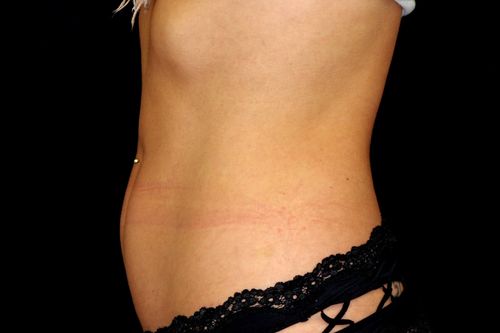 Before And After Patient Image