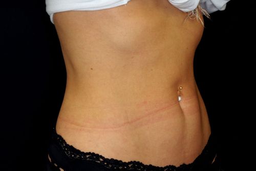 Before And After Patient Image