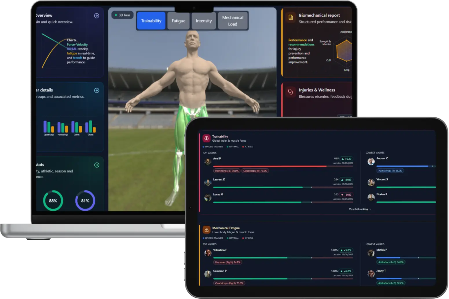 Écrans de surveillance Preditwins