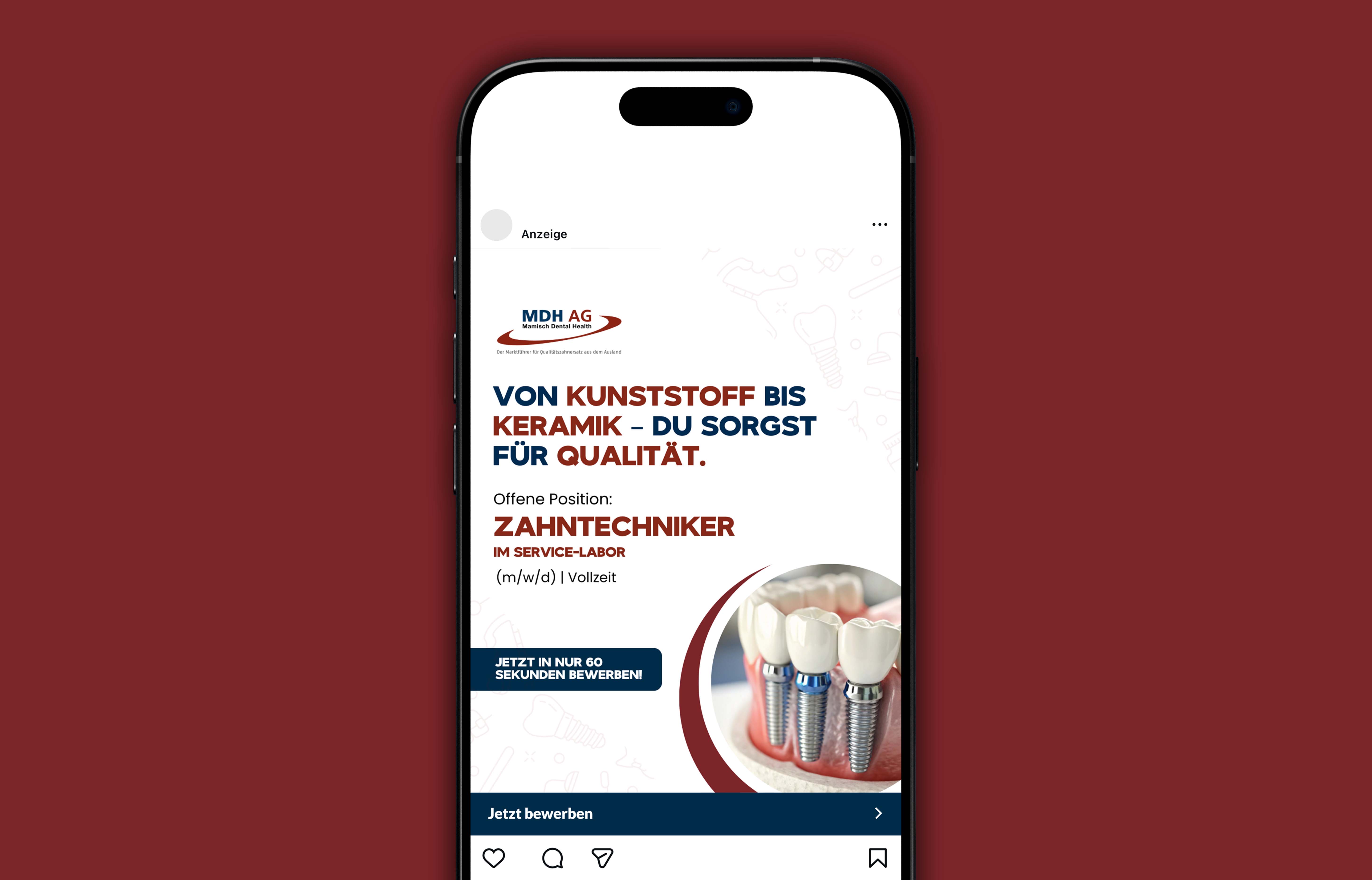 Anzeige auf Smartphone für Zahntechniker im Service-Labor bei MDH AG mit Bild von Zahnimplantaten.