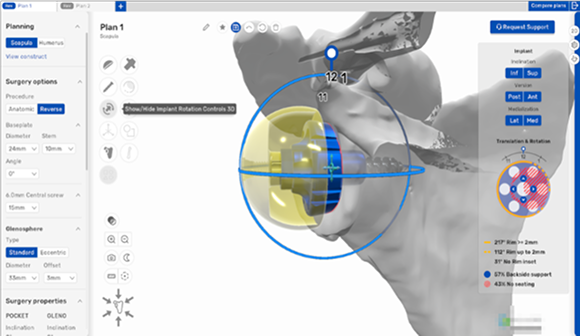 A 3D model of a human body is shown on a computer screen, focusing on the structure of the shoulder bone.