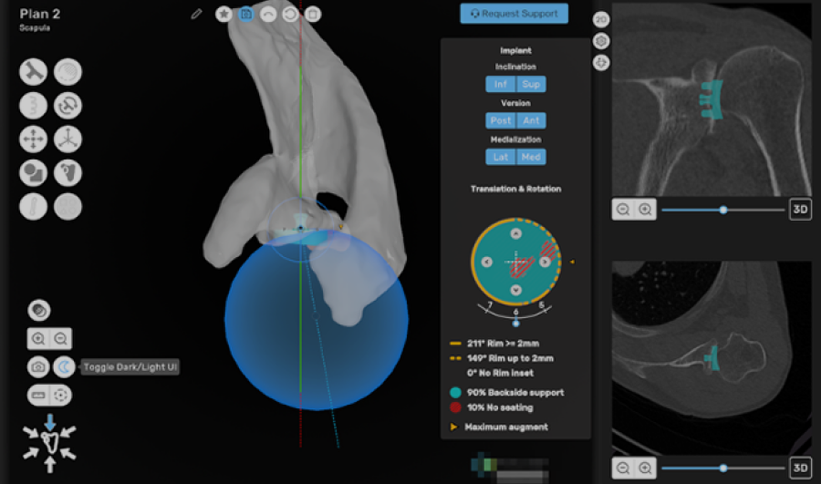 A 3D model of a human body is shown on a computer screen, focusing on the structure of the shoulder bone.