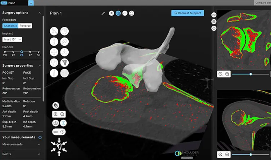 A 3D model of a human body is shown on a computer screen, focusing on the structure of the shoulder bone.
