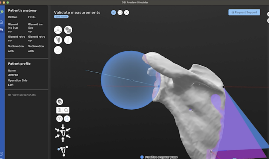 A 3D model of a human body is shown on a computer screen, focusing on the structure of the shoulder bone.