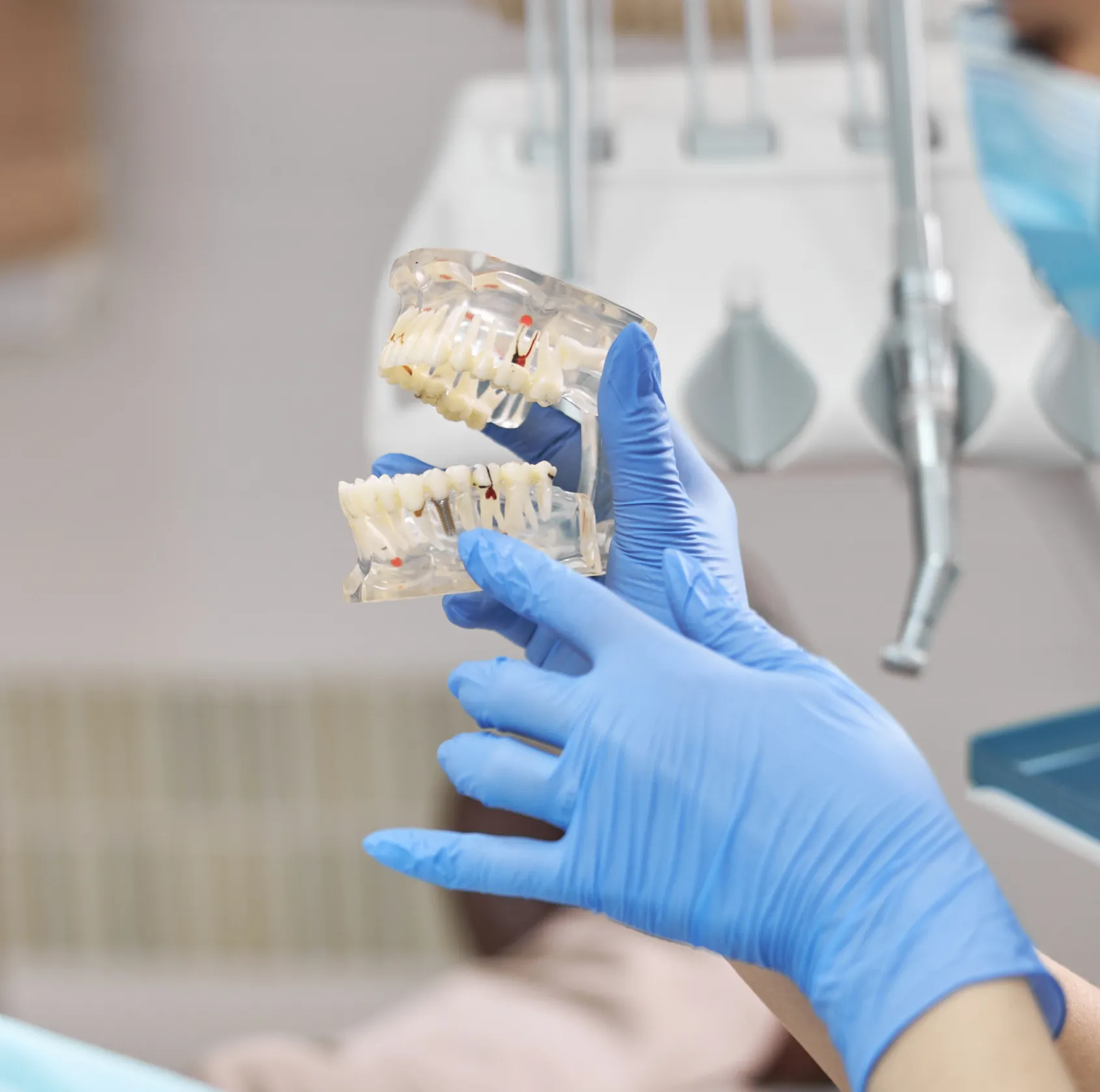 Dentist wearing blue gloves holding a transparent dental model showing teeth and dental implants.