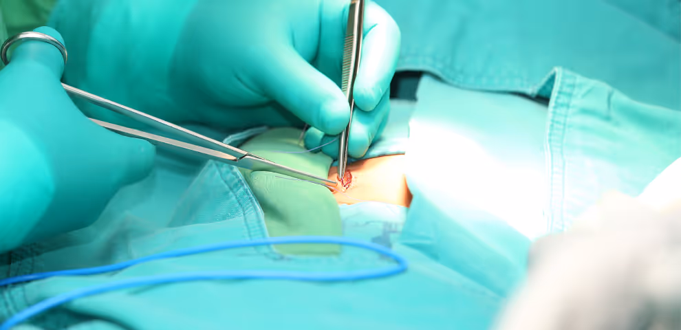 Image of surgery
