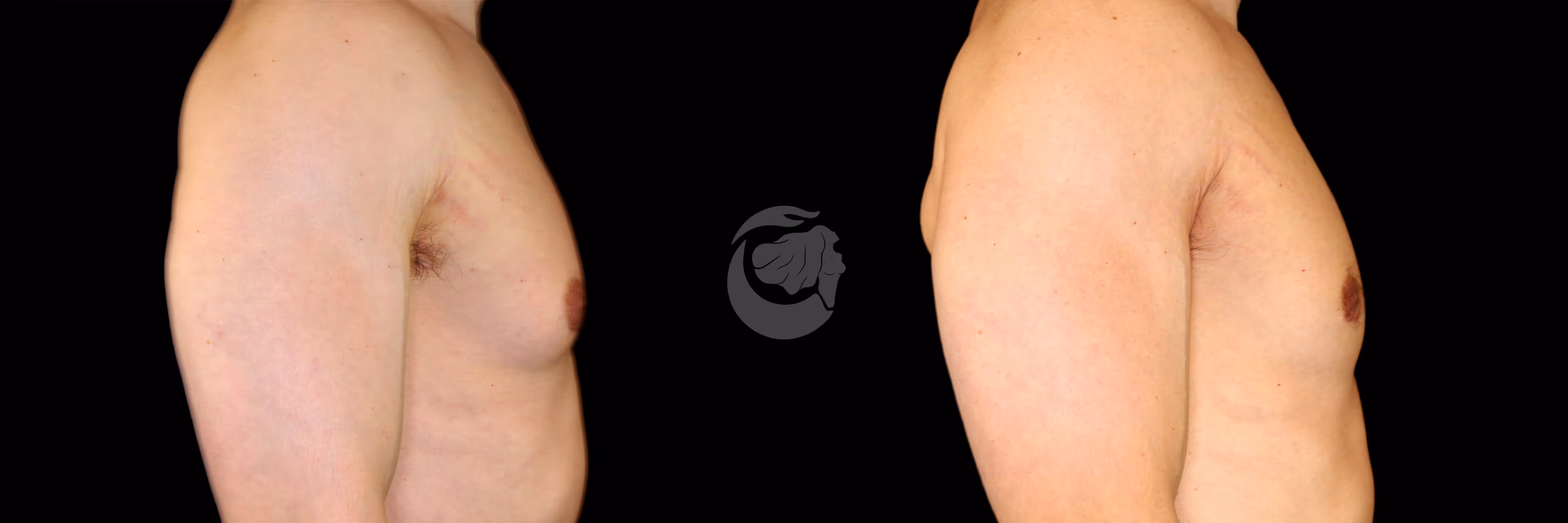 Before And After Patient Image
