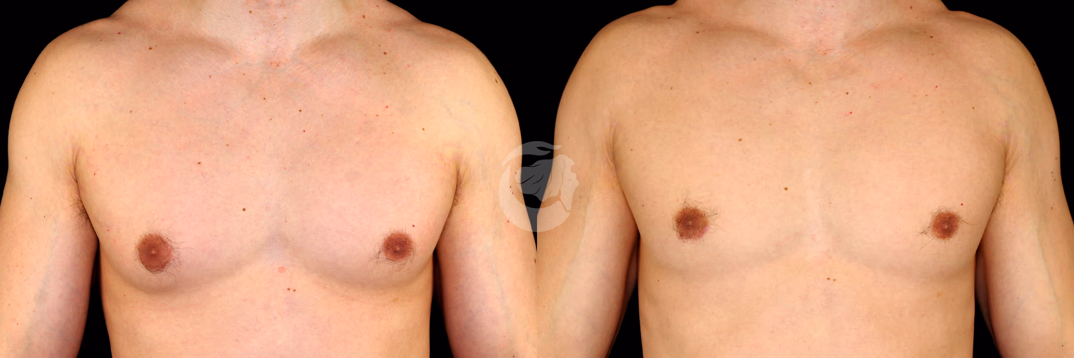 Before And After Patient Image