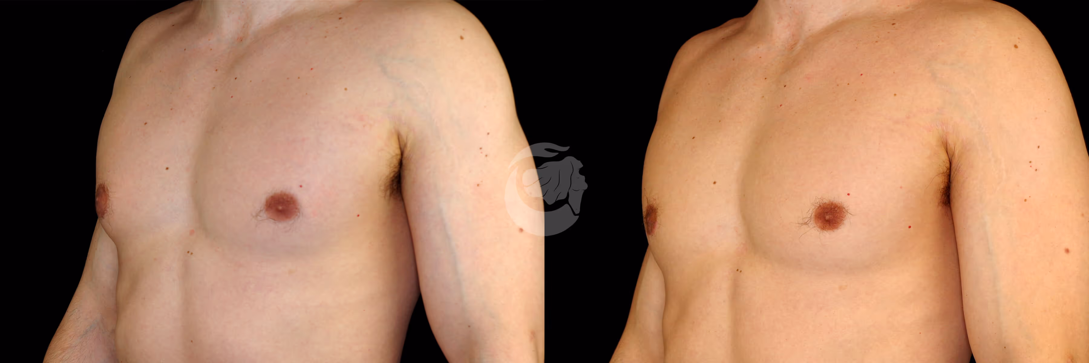Before And After Patient Image