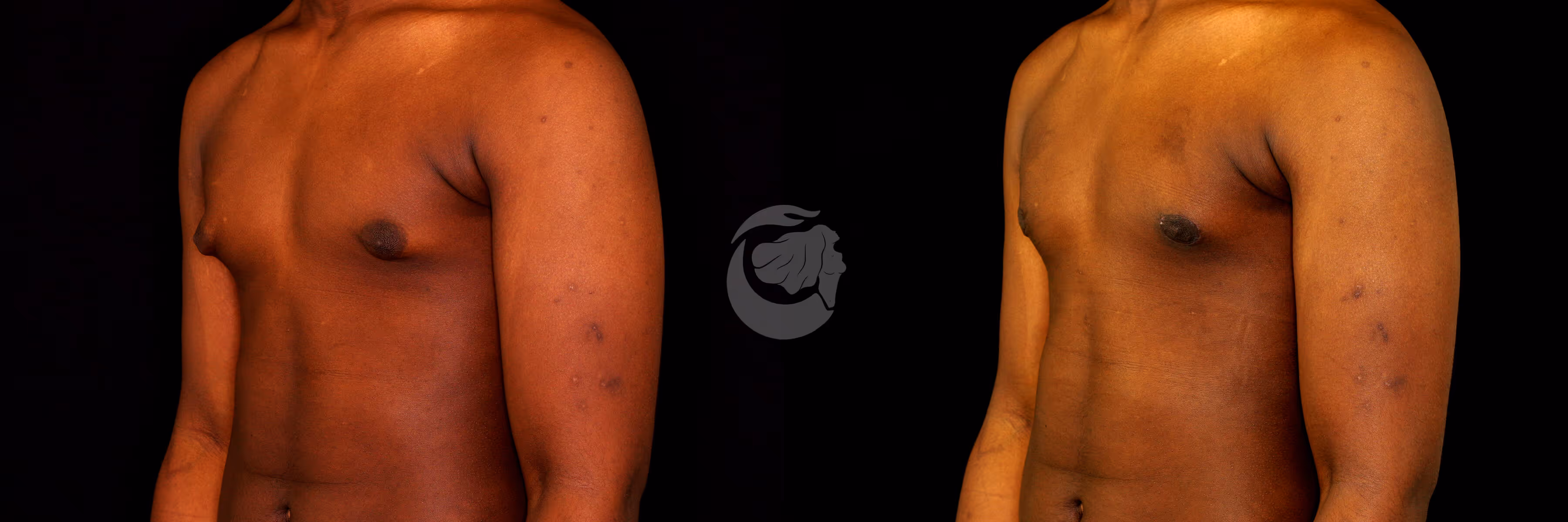 Before And After Patient Image