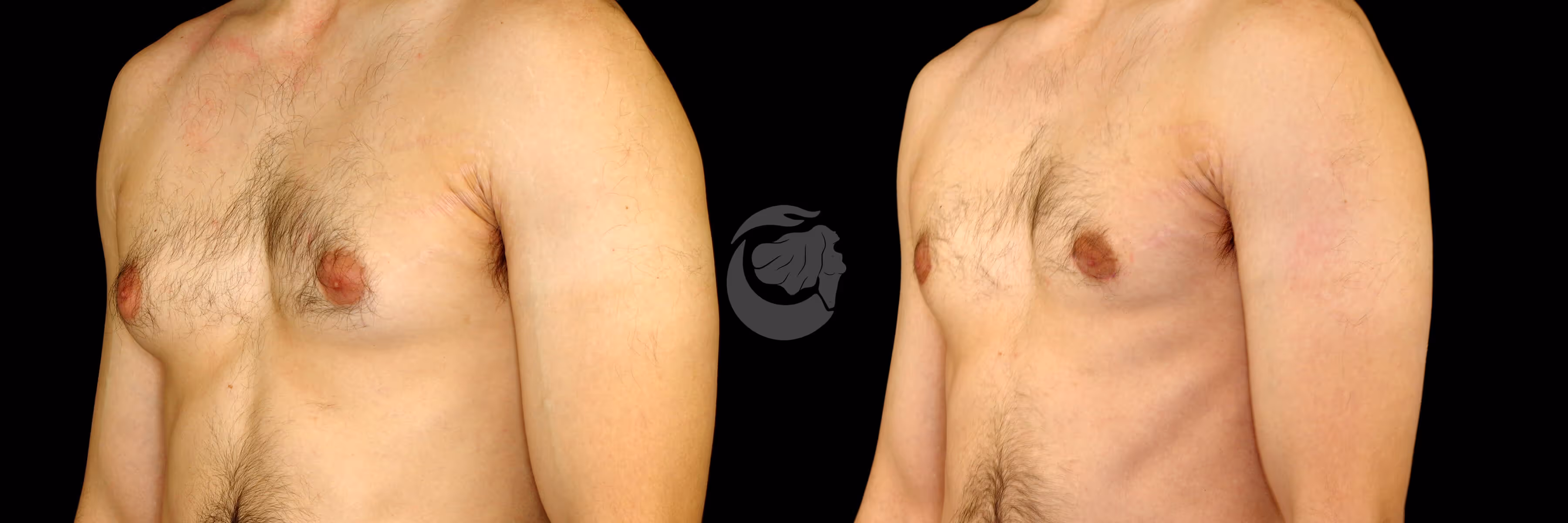 Before And After Patient Image