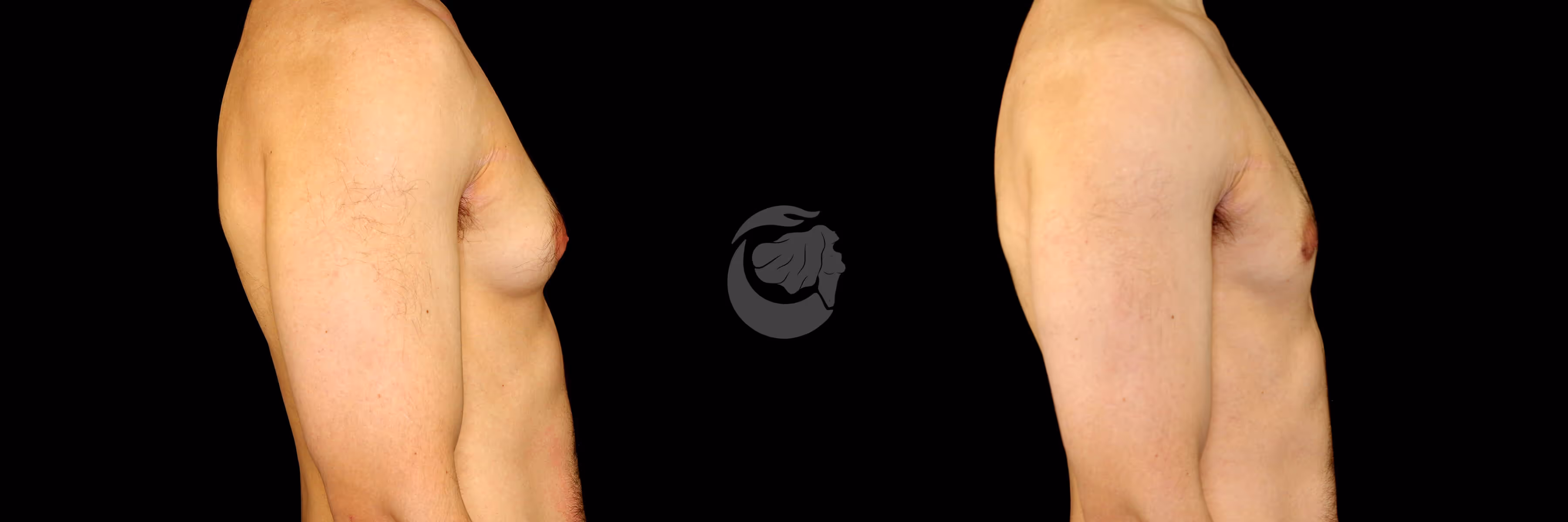 Before And After Patient Image