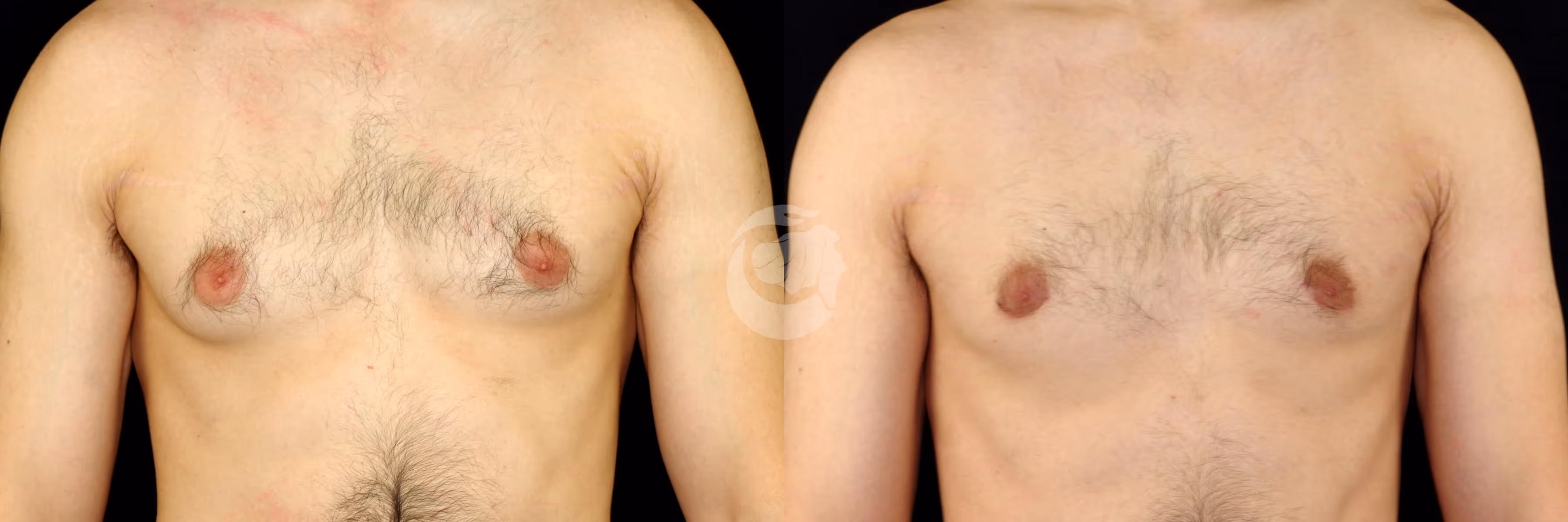 Before And After Patient Image