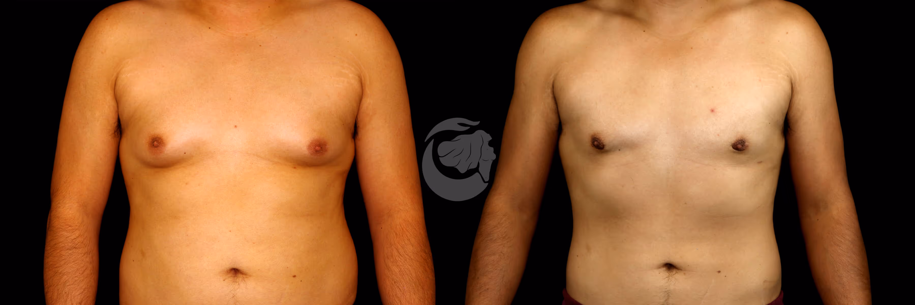 Before And After Patient Image