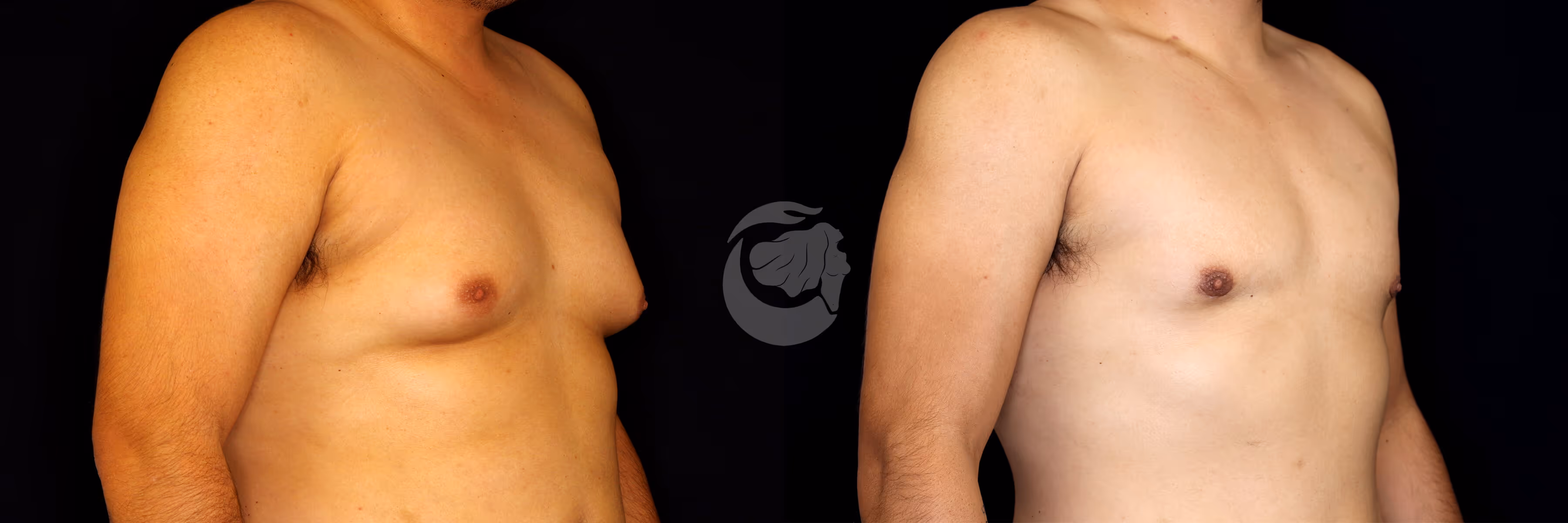 Before And After Patient Image
