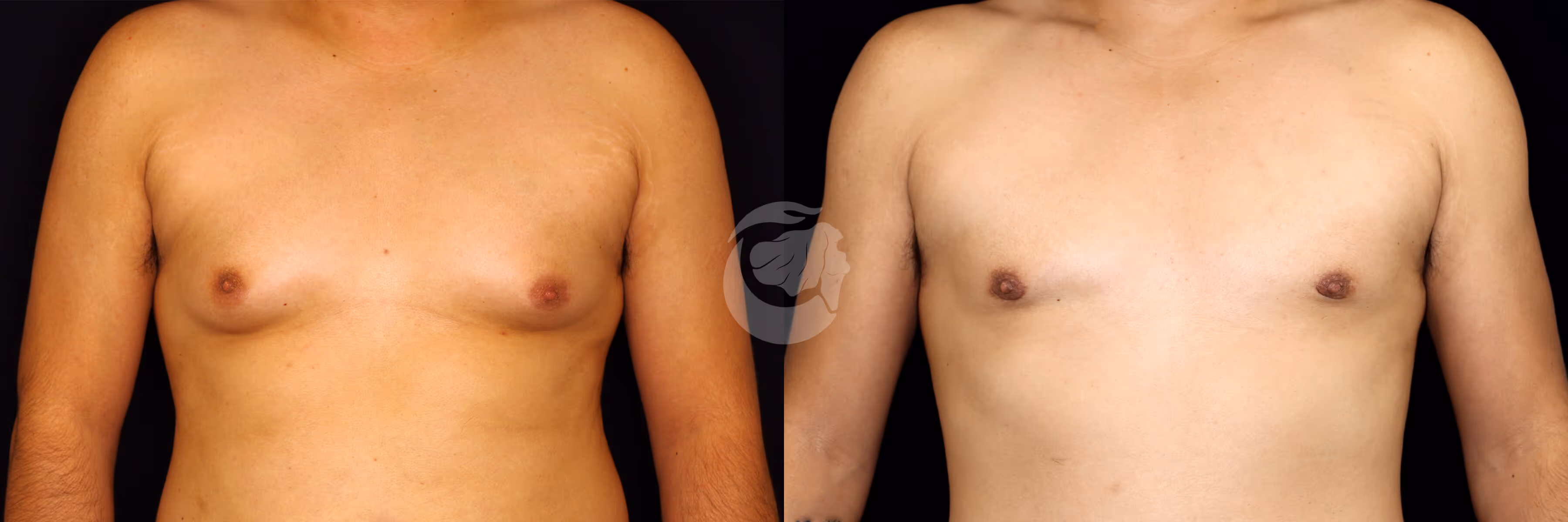 Before And After Patient Image