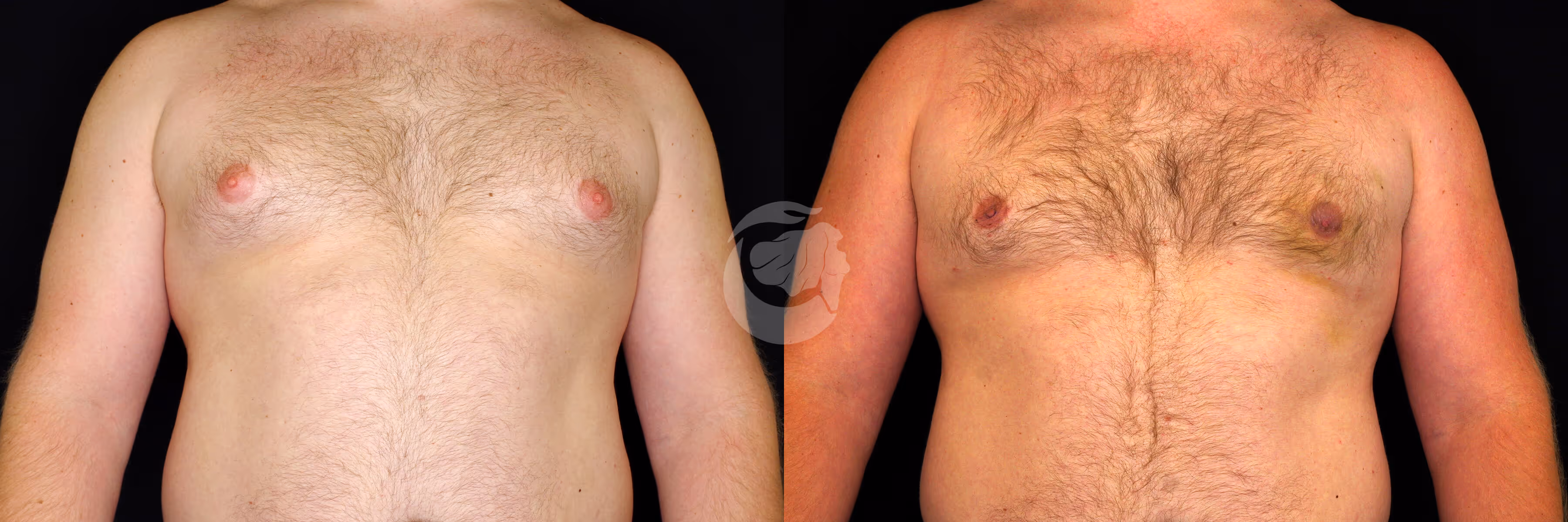 Before And After Patient Image