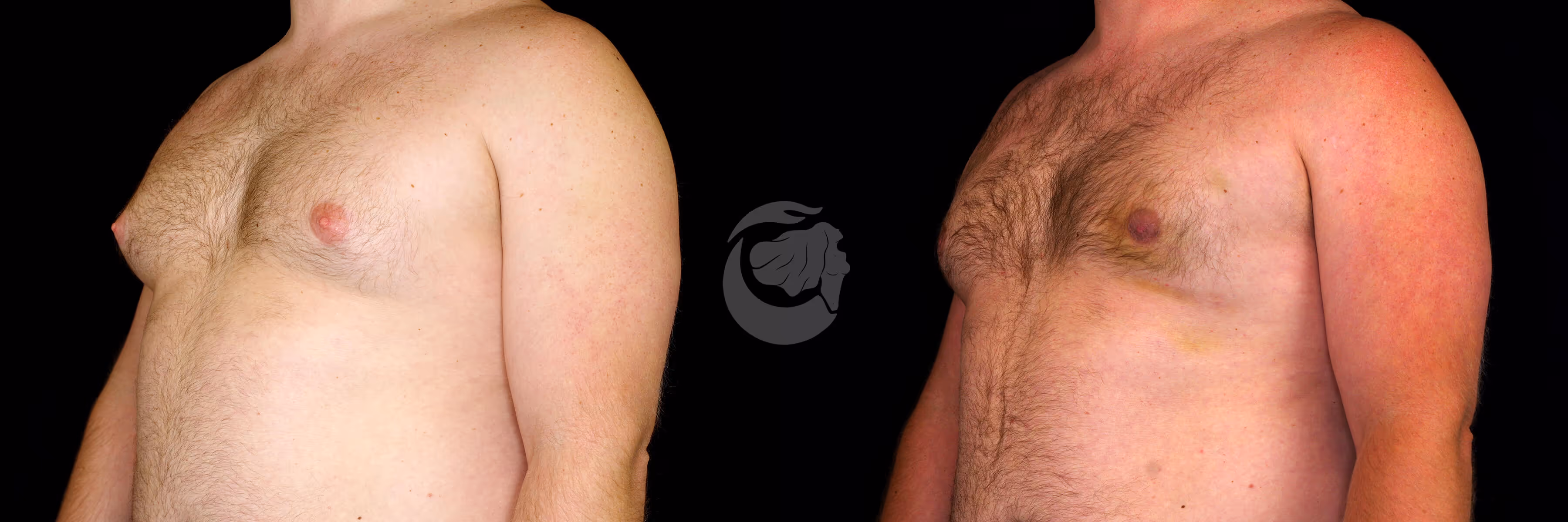 Before And After Patient Image