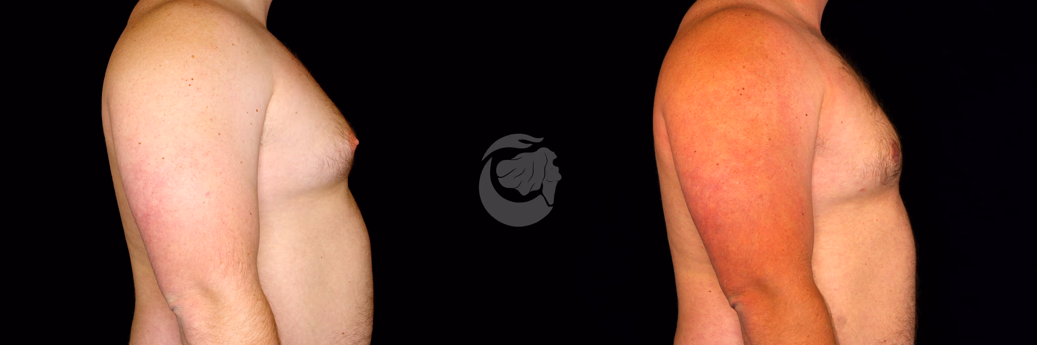 Before And After Patient Image