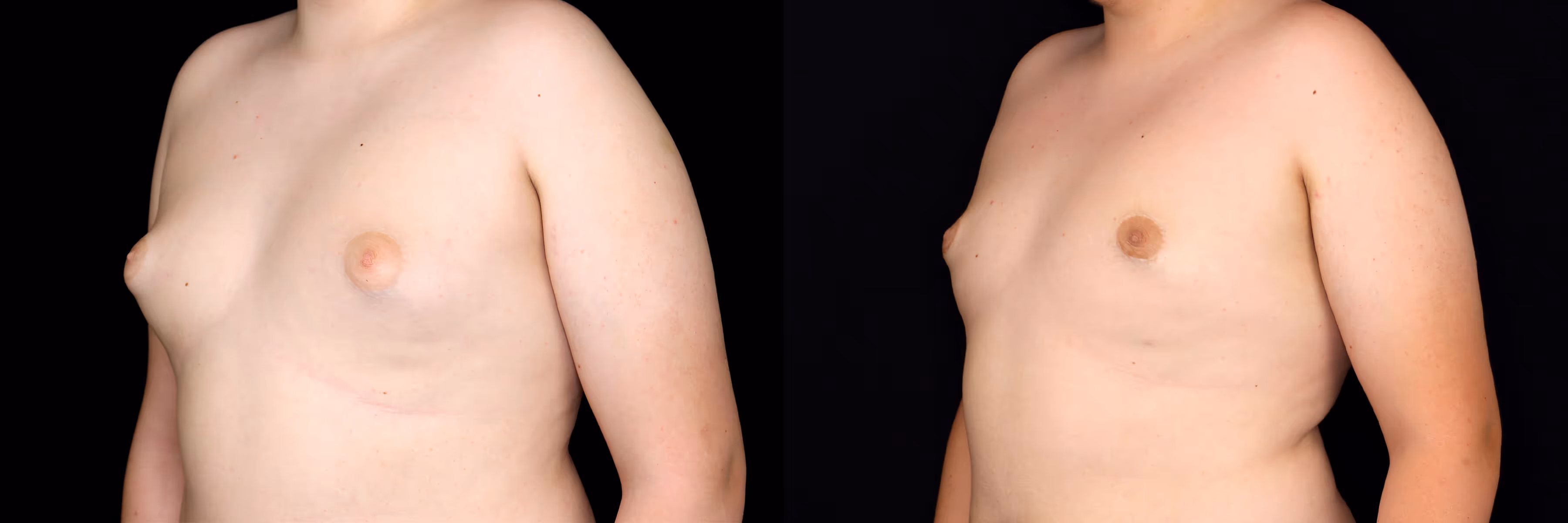Before And After Patient Image