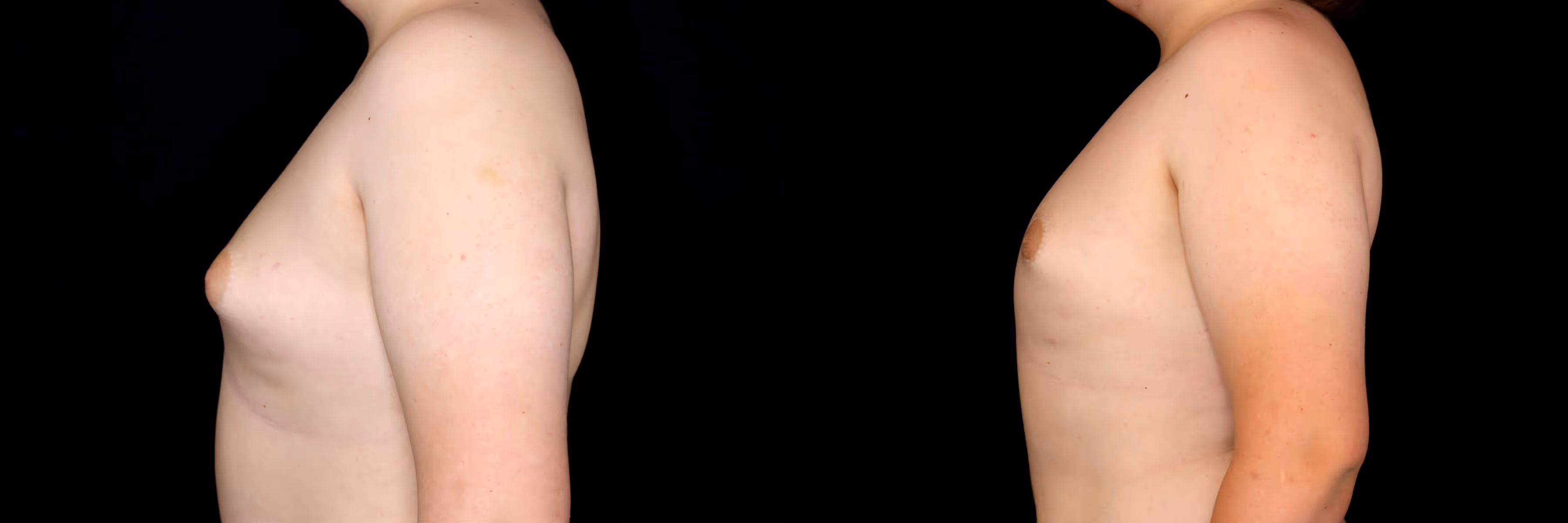 Before And After Patient Image