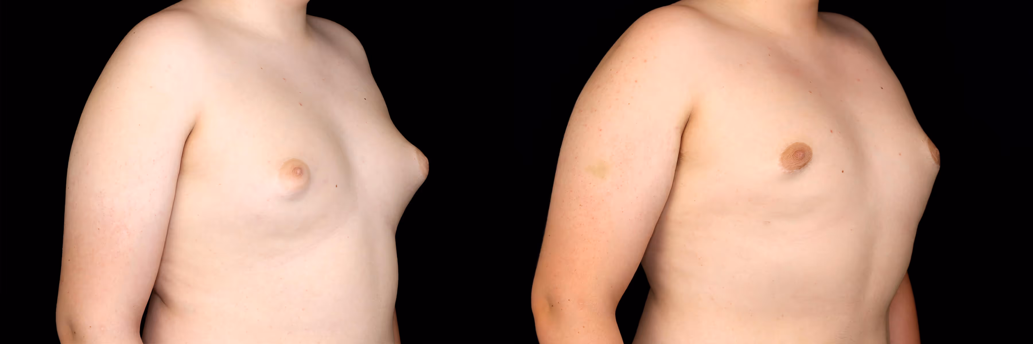 Before And After Patient Image