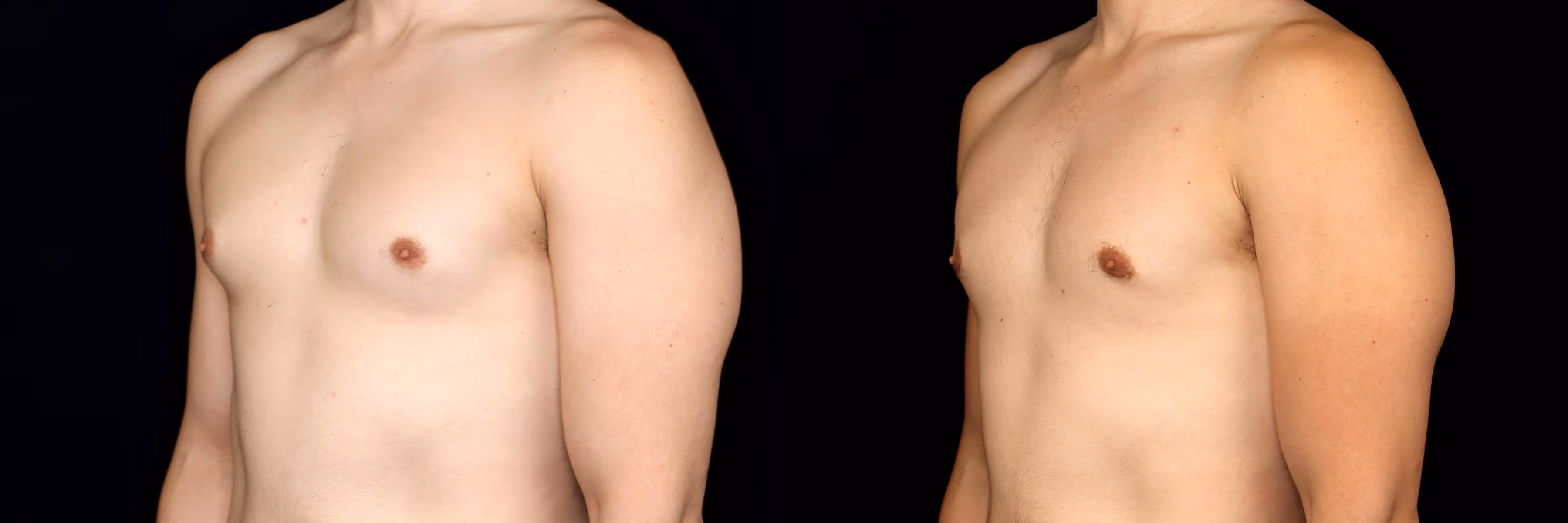 Before And After Patient Image