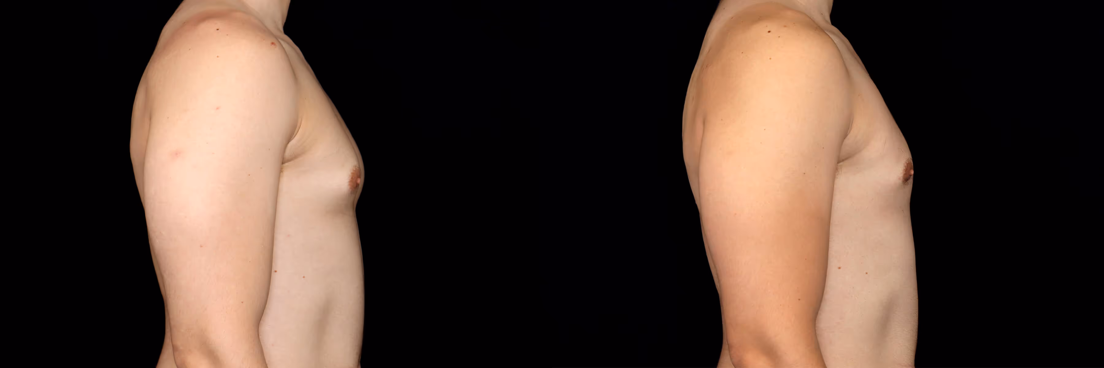 Before And After Patient Image