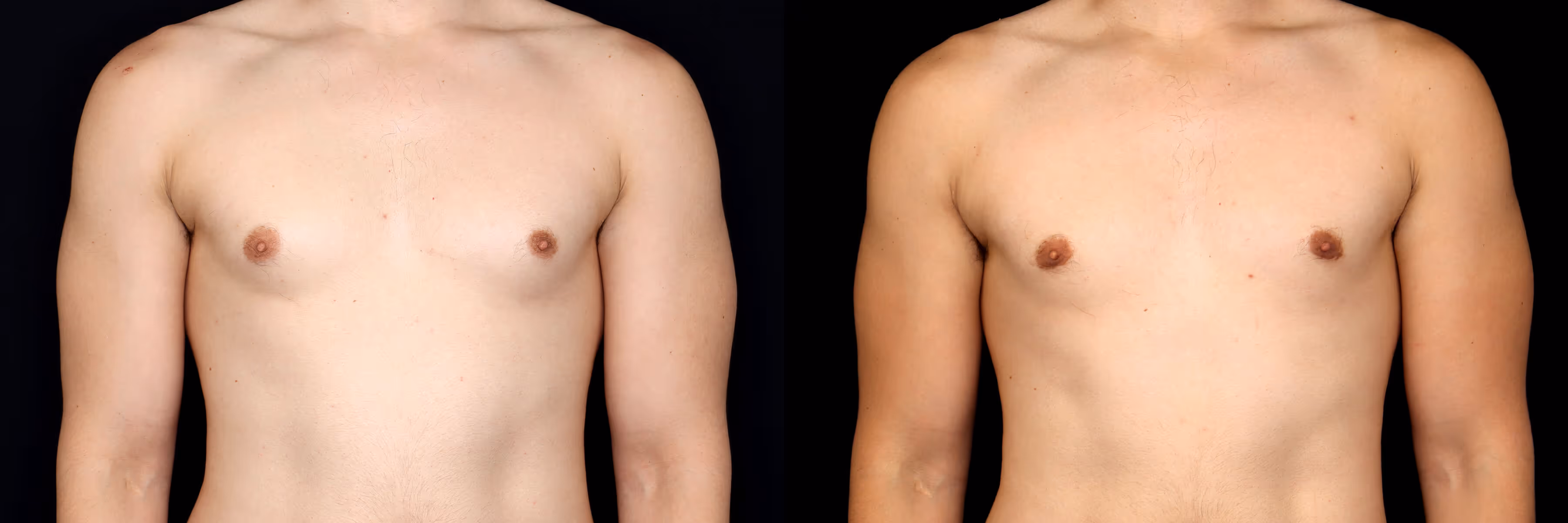 Before And After Patient Image