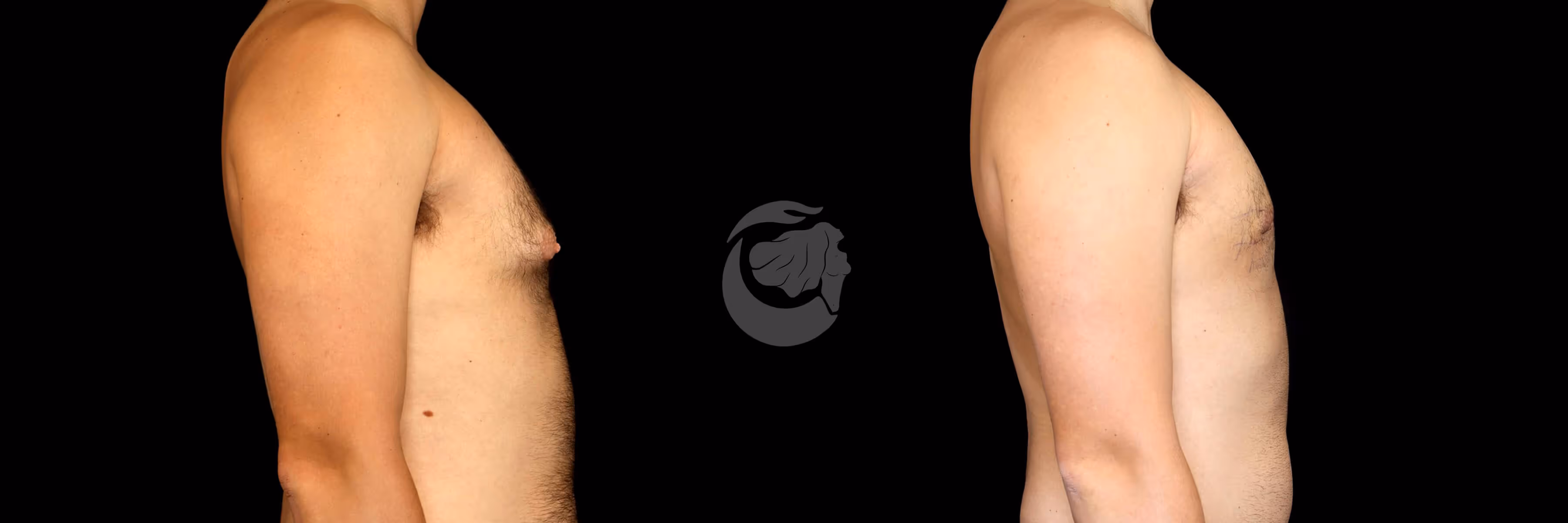 Before And After Patient Image