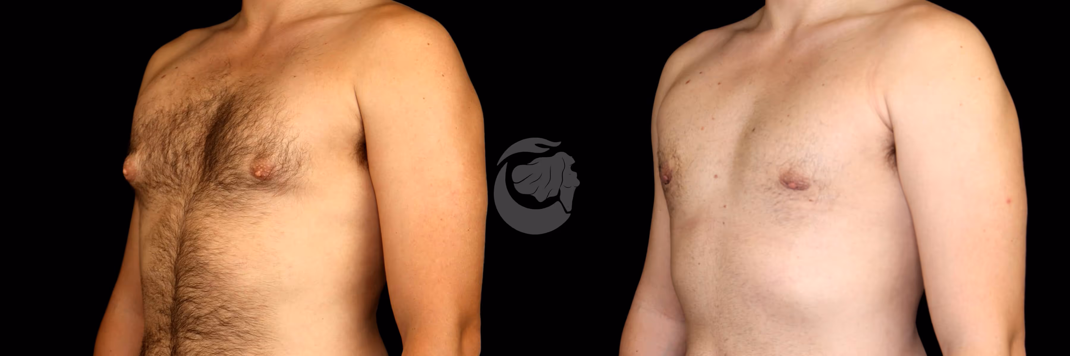Before And After Patient Image