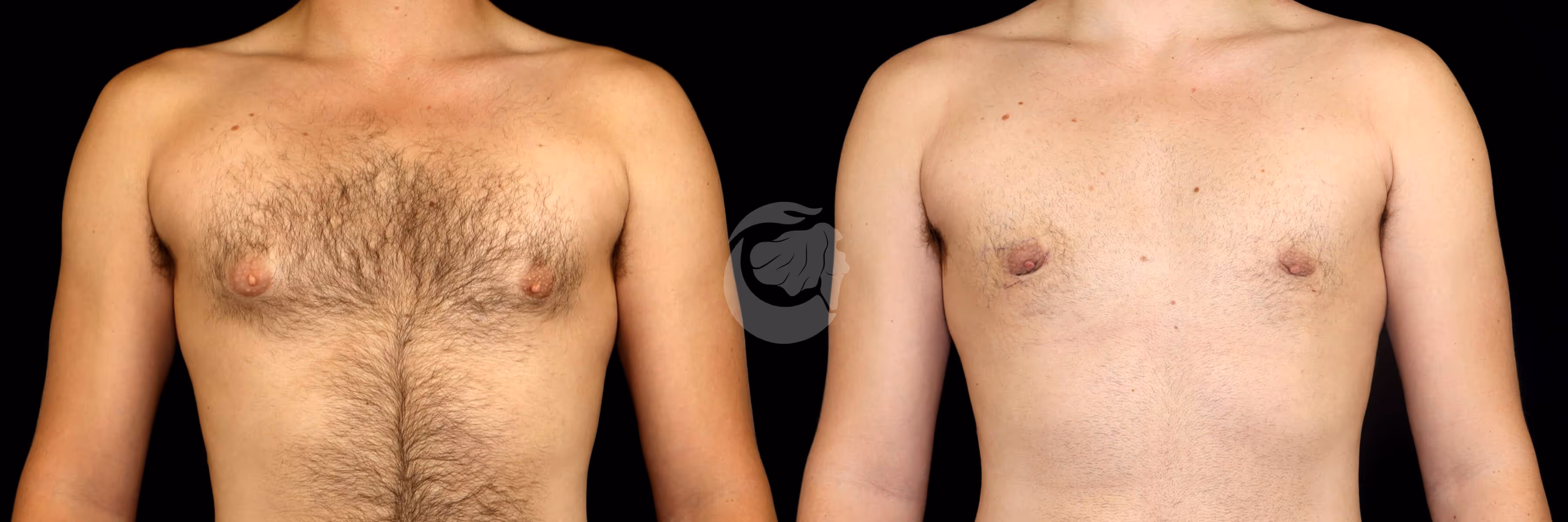 Before And After Patient Image