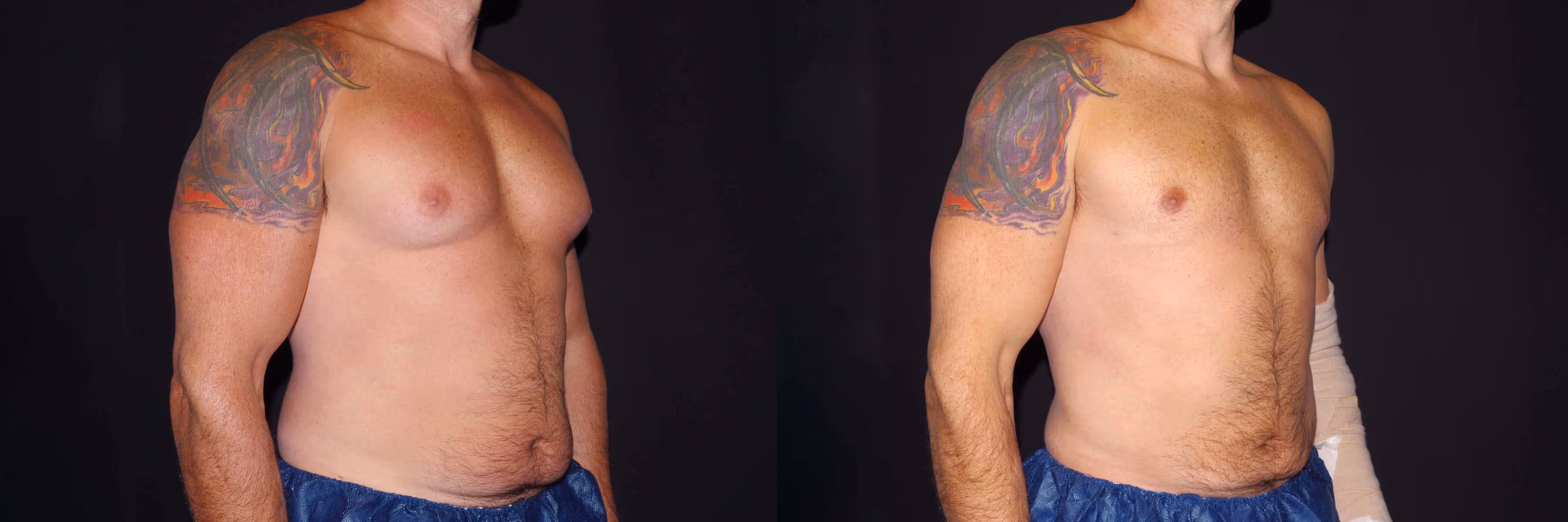Before And After Patient Image