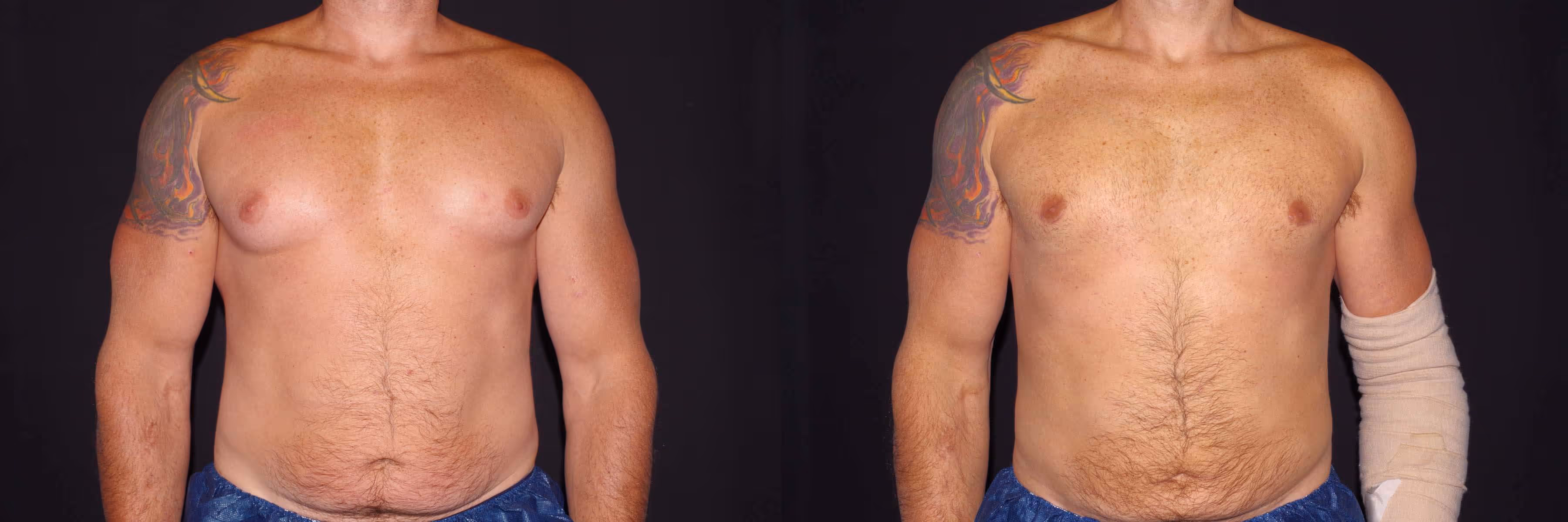 Before And After Patient Image