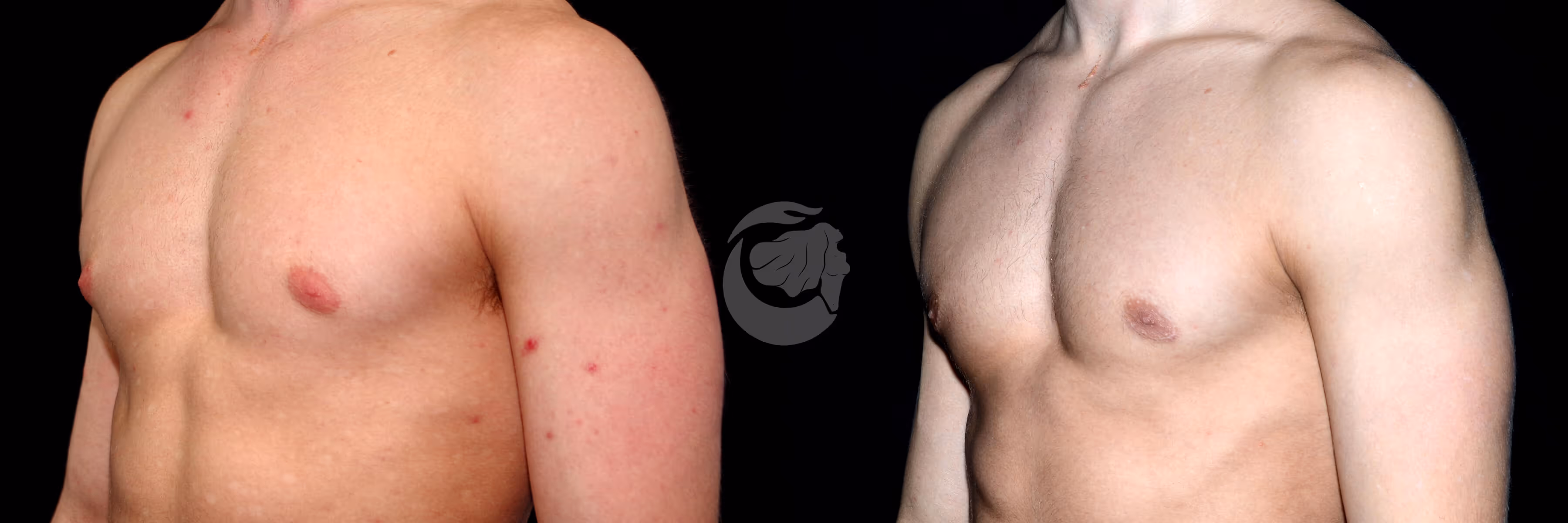 Before And After Patient Image