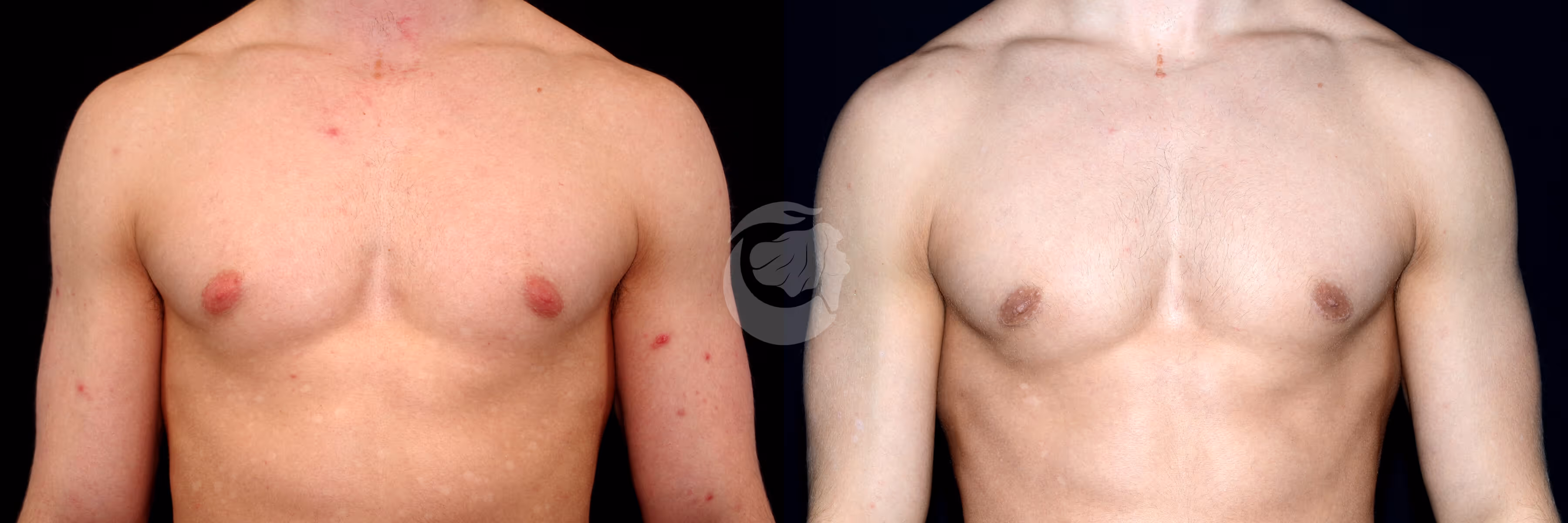 Before And After Patient Image