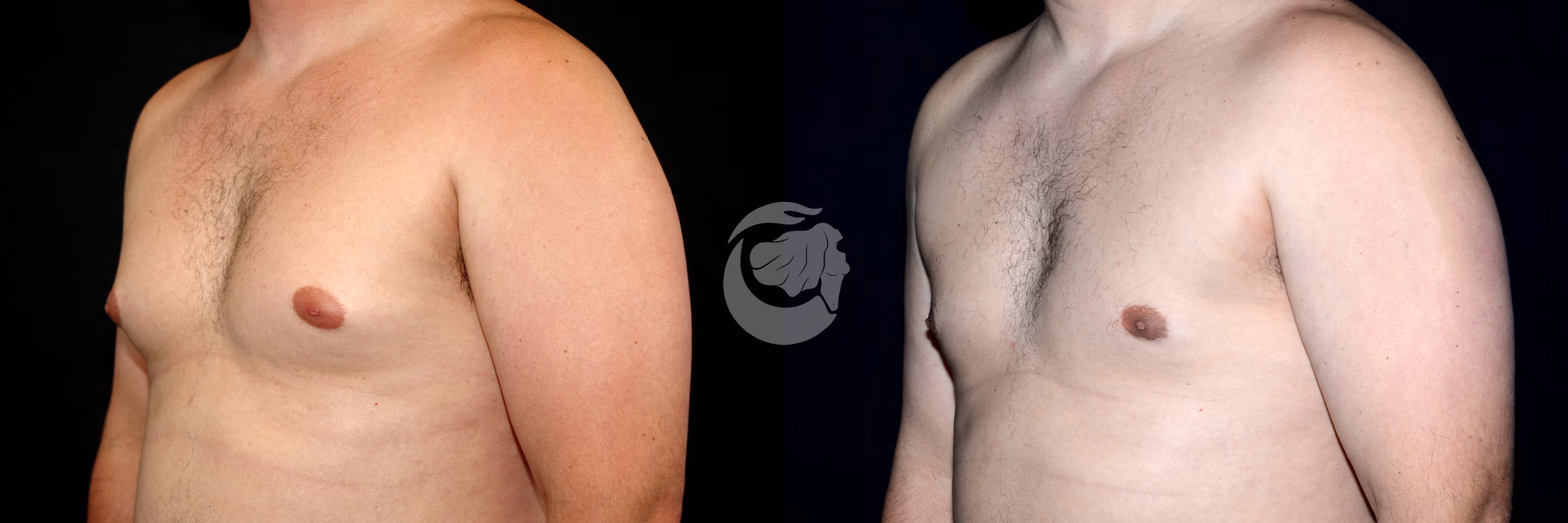 Before And After Patient Image