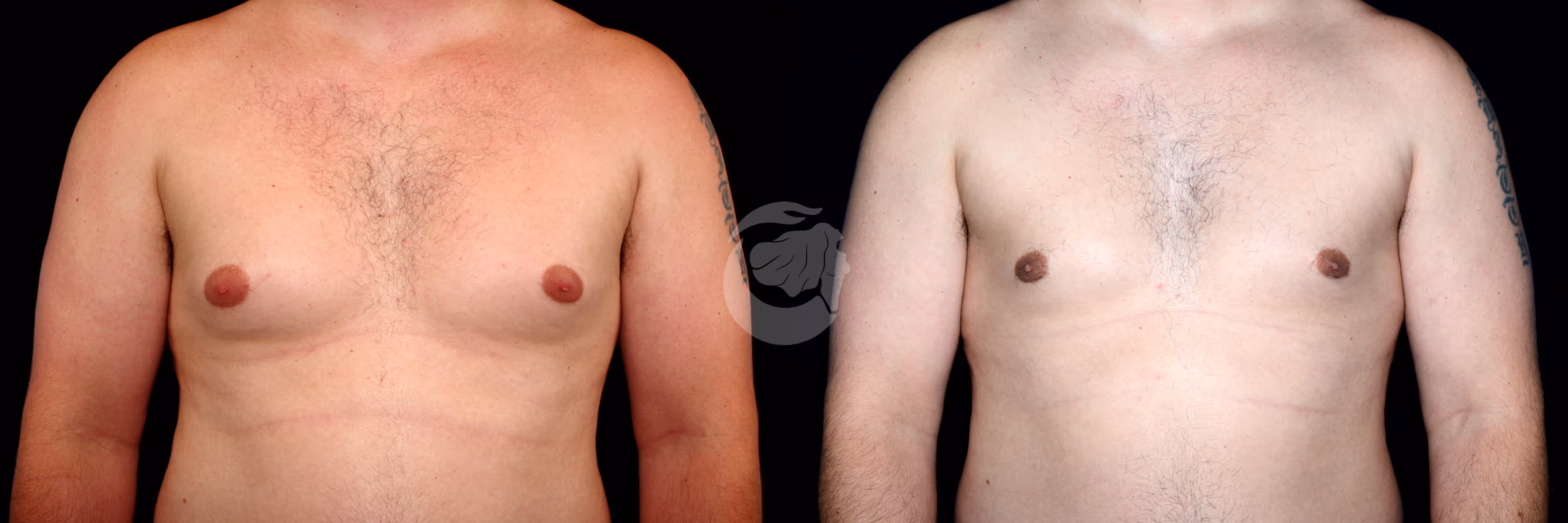 Before And After Patient Image
