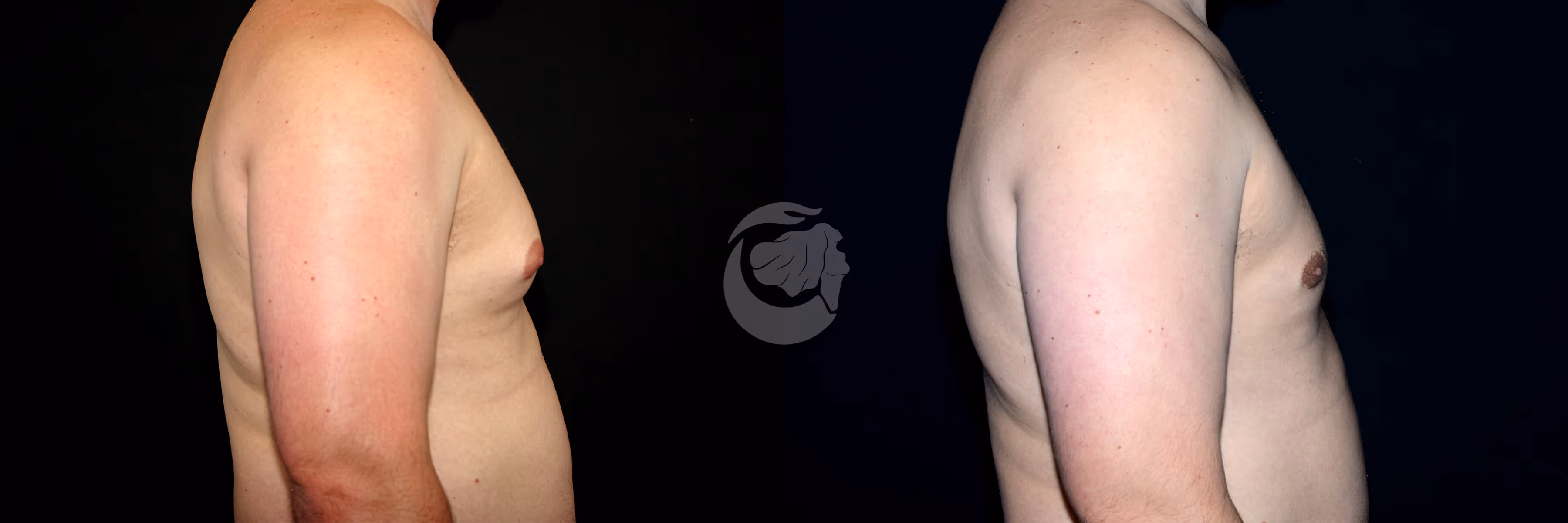 Before And After Patient Image