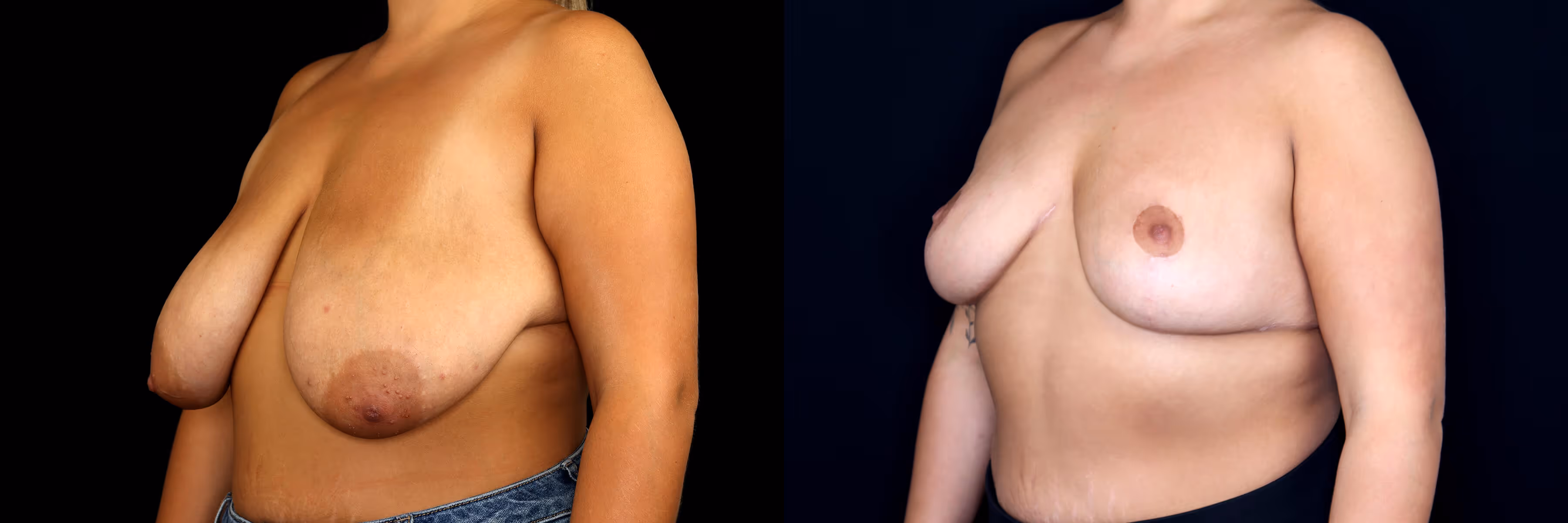 Before And After Patient Image