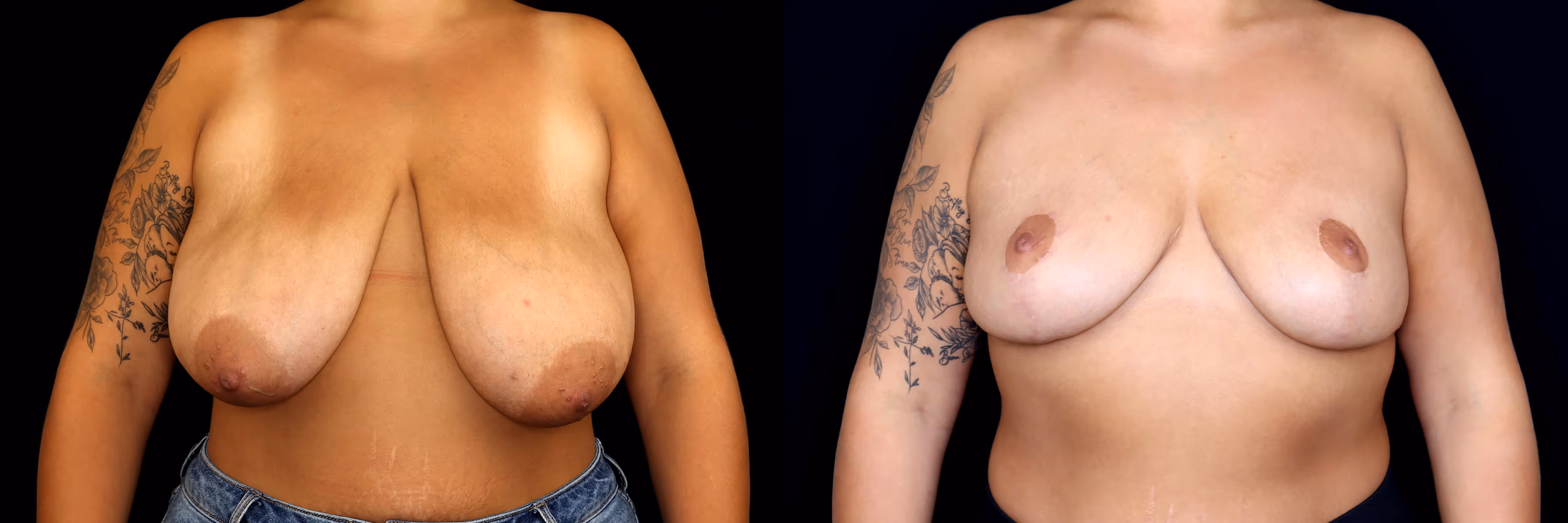 Before And After Patient Image