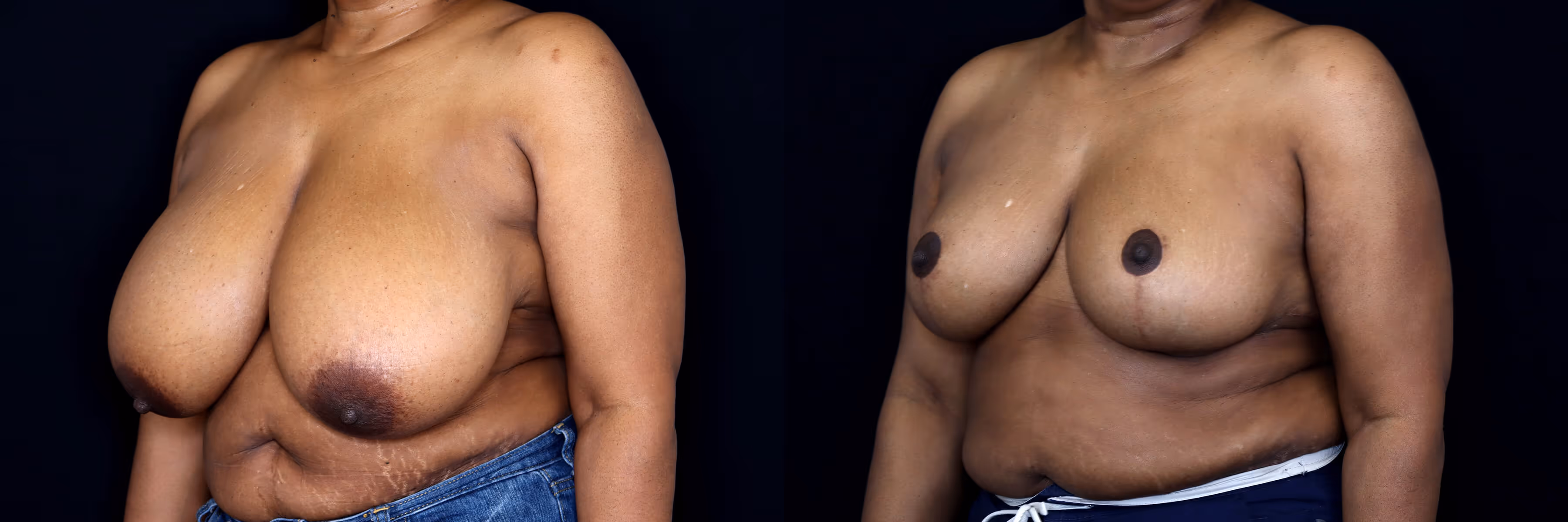 Before And After Patient Image