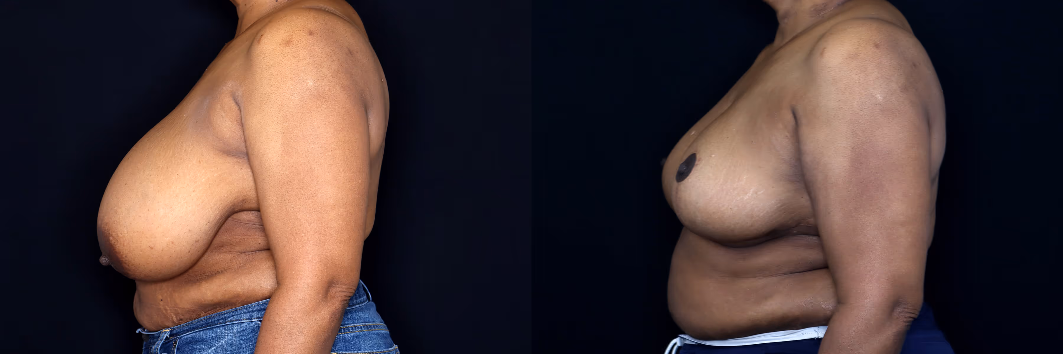 Before And After Patient Image