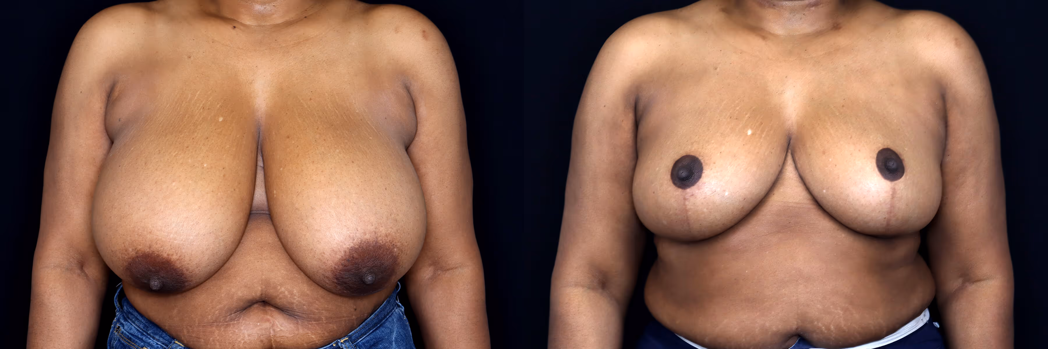 Before And After Patient Image