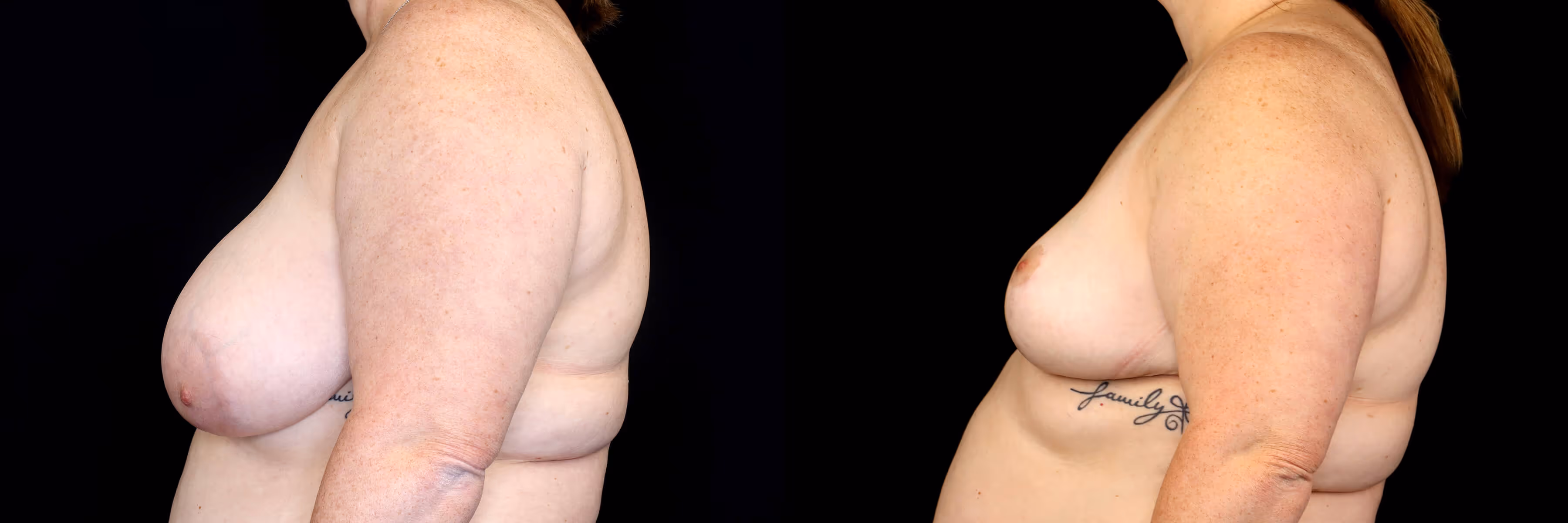Before And After Patient Image
