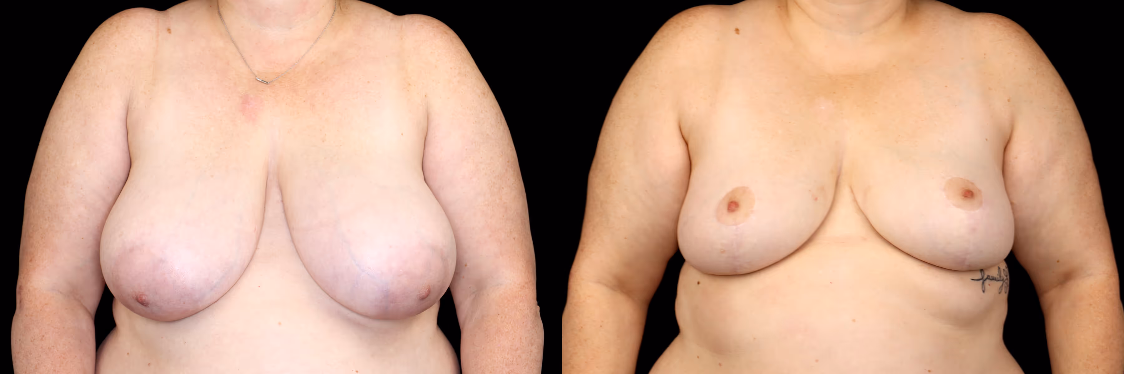 Before And After Patient Image